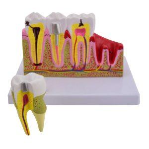 Моделі зубів