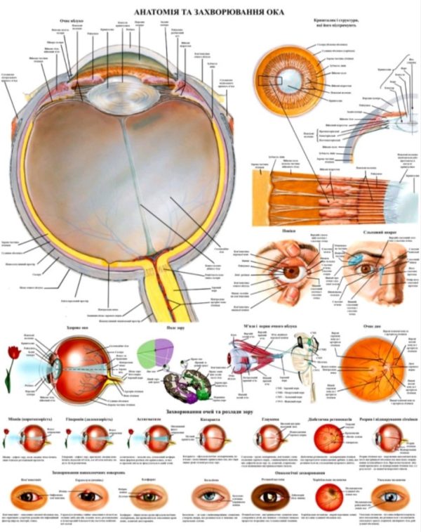 Плакат - Анвтомія та захворювання ока