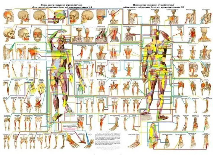 Комплект із 2-х плакатів Повна карта тригерних пунктів з областями відбитого болю 119*86 см